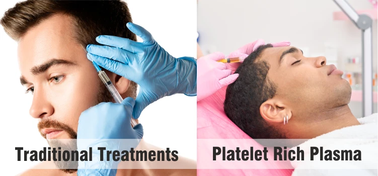 Platelet Rich Plasma vs. Traditional Treatments